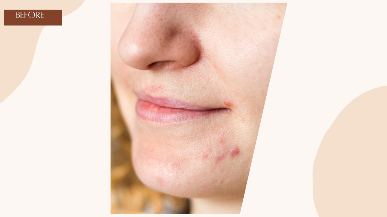 image comparison after